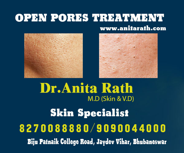 Best open pores treatment in Bhubaneswar, Odisha